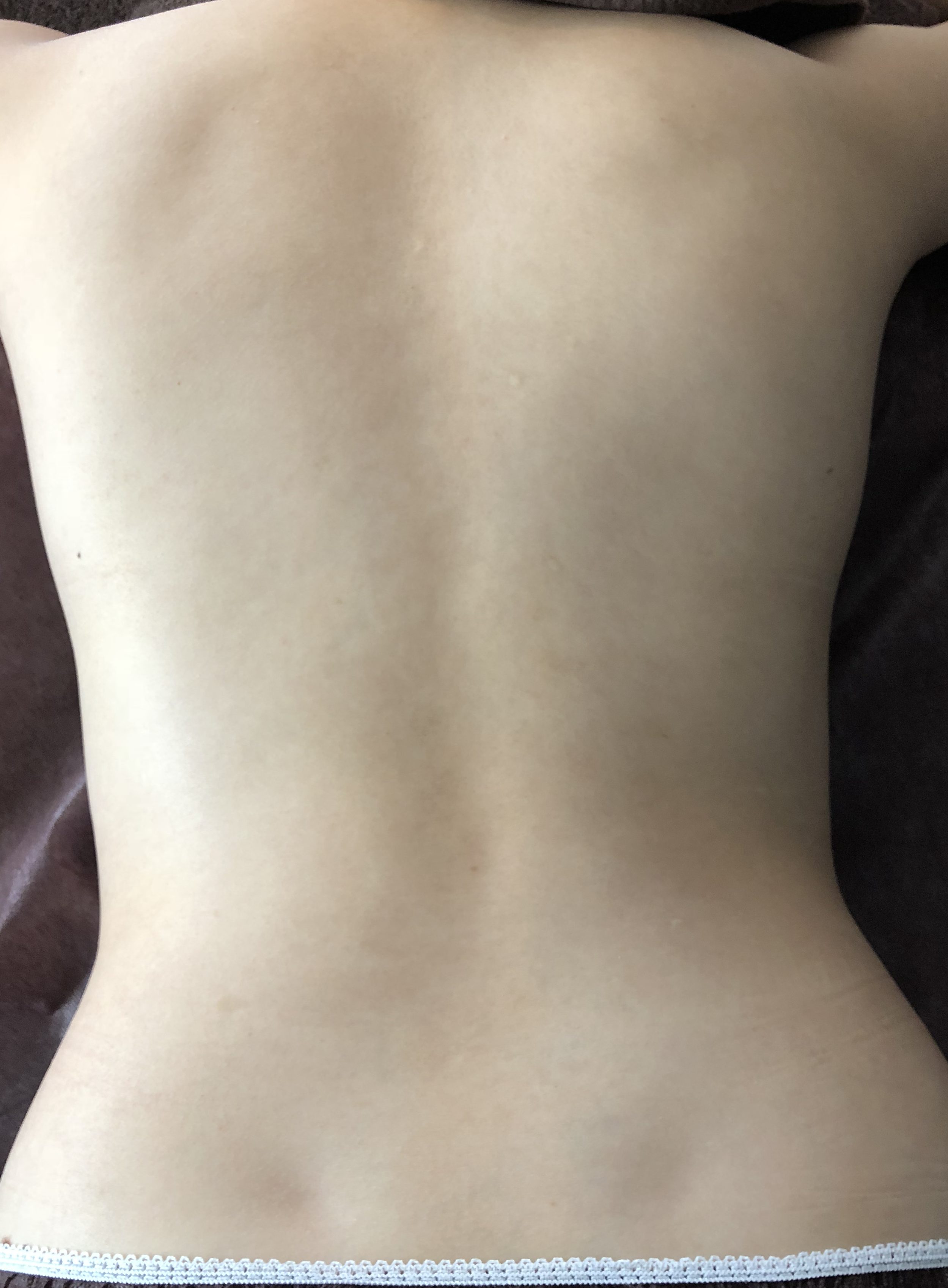 20B_背中